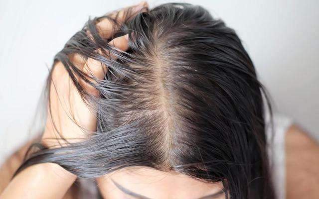 oily hair follicles