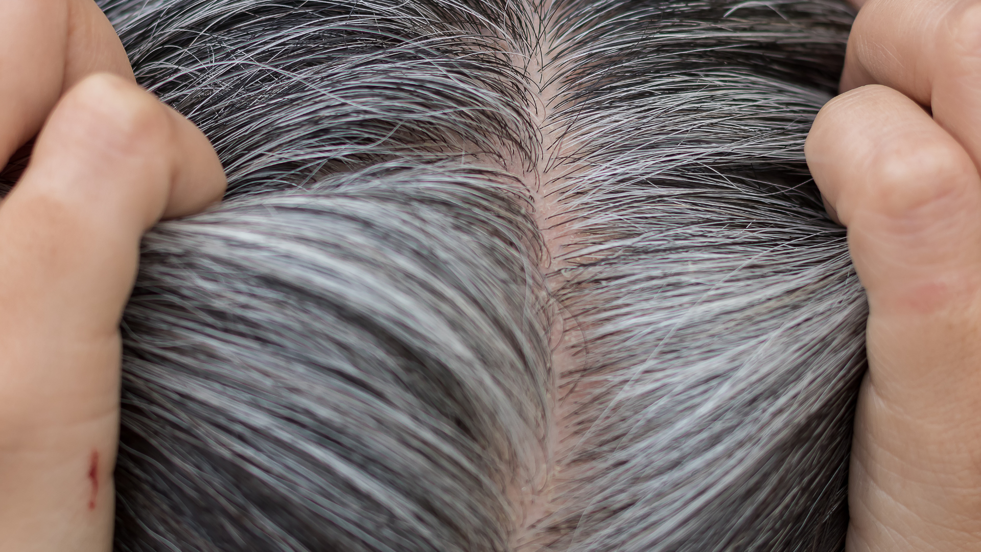 One of The Best Grey Hair Treatment in Singapore