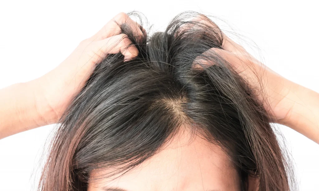 How to Regain Hair Loss from Stress | Exact 7 Steps – Equi Botanics